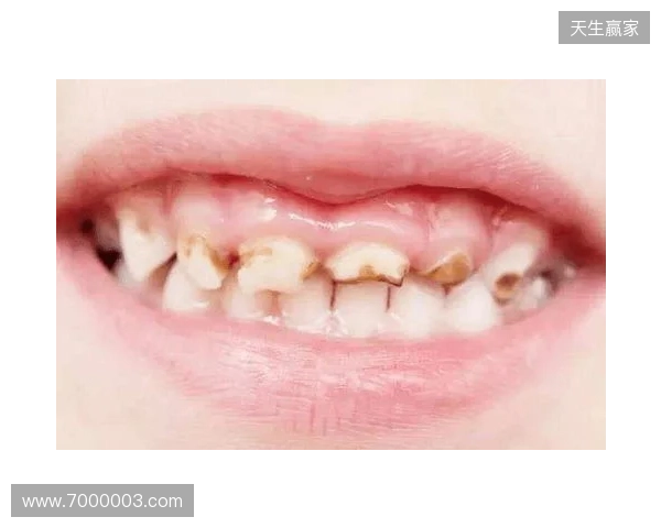 韦林顿确诊上唇部贯通伤;11、21牙半脱位;上颌前牙区牙槽骨骨折 韦林顿确诊上唇部贯通伤;11、21牙半脱位;上颌前牙区牙槽骨骨折